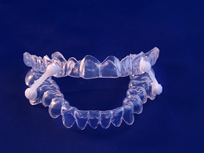 Elite Dental Spa | Teeth-In-A-Day®, Ceramic Crowns and Oral Appliance Therapy