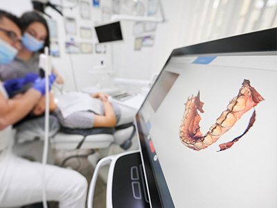 Elite Dental Spa | Cosmetic Dentistry, All-on-6® and Intraoral Camera